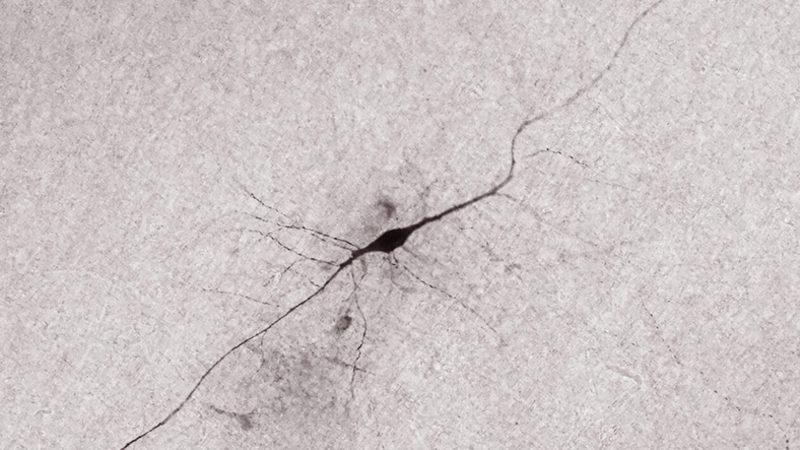 Araştırmacılar, Gizemli Bir Beyin Hücresinin Aktivitesini İlk Kez Kaydetti