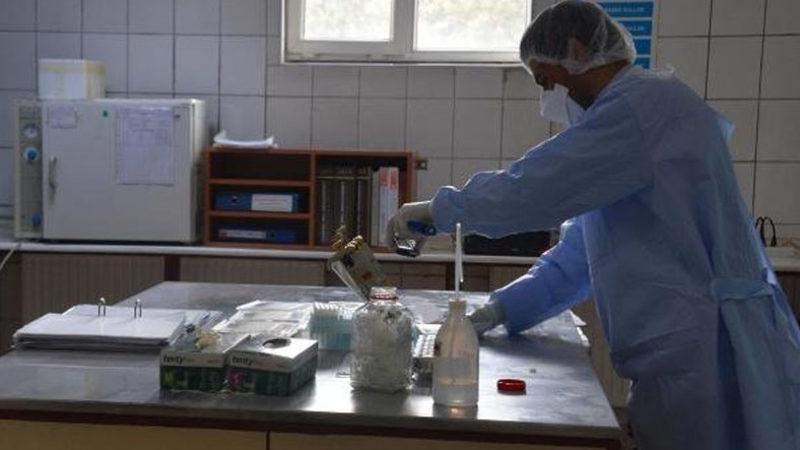 Türkiye’de Corona Virüsü Testleri İşte Bu Laboratuvarda Yapılıyor