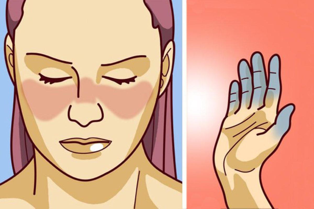 Bilim İnsanları, Önemli Bir Hastalık Olan Lupusun Sebebini Ortaya Çıkardı