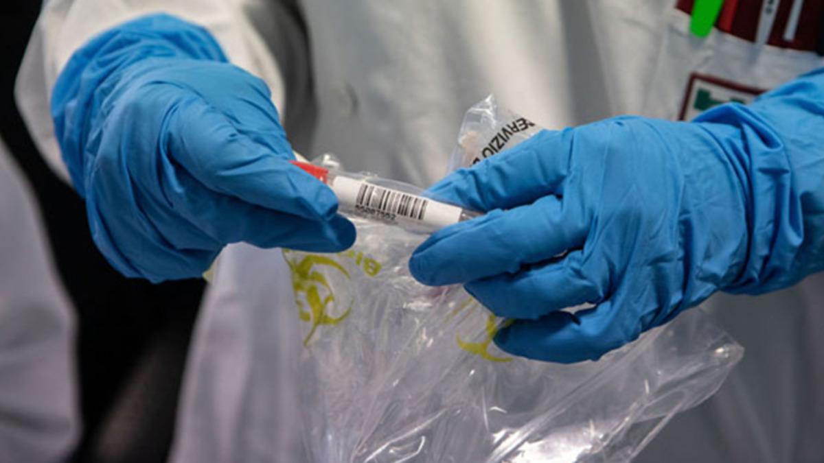 Kanada Merkezli Bir Şirket, Corona Virüsünün Aşısını Bulduğunu Açıkladı