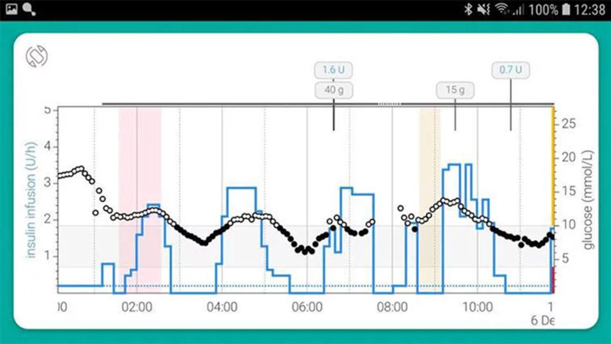 Tip 1 Diyabet Hastalarının Hayatını Kolaylaştıracak Bir Uygulama Geliştirildi