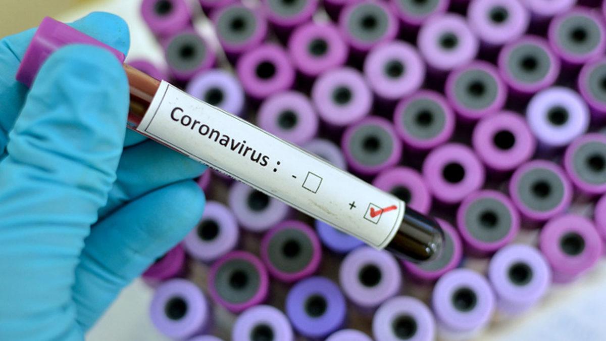 Koronavirüs Tedavisi İçin İyileşenlerin Kanı, Yeni Hastalara Enjekte Edilecek