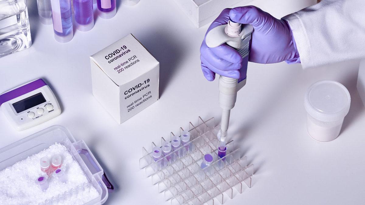 Corona Virüsü Testi Nerede ve Nasıl Yapılıyor? Türkiye’de İşleyen Tüm Prosedürü Adım Adım Anlattık