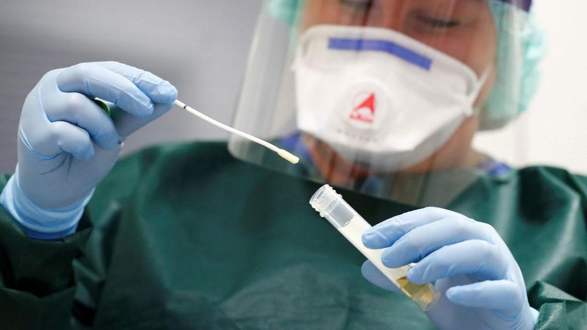 Corona Virüsü Testi Nerede ve Nasıl Yapılıyor? Türkiye’de İşleyen Tüm Prosedürü Adım Adım Anlattık