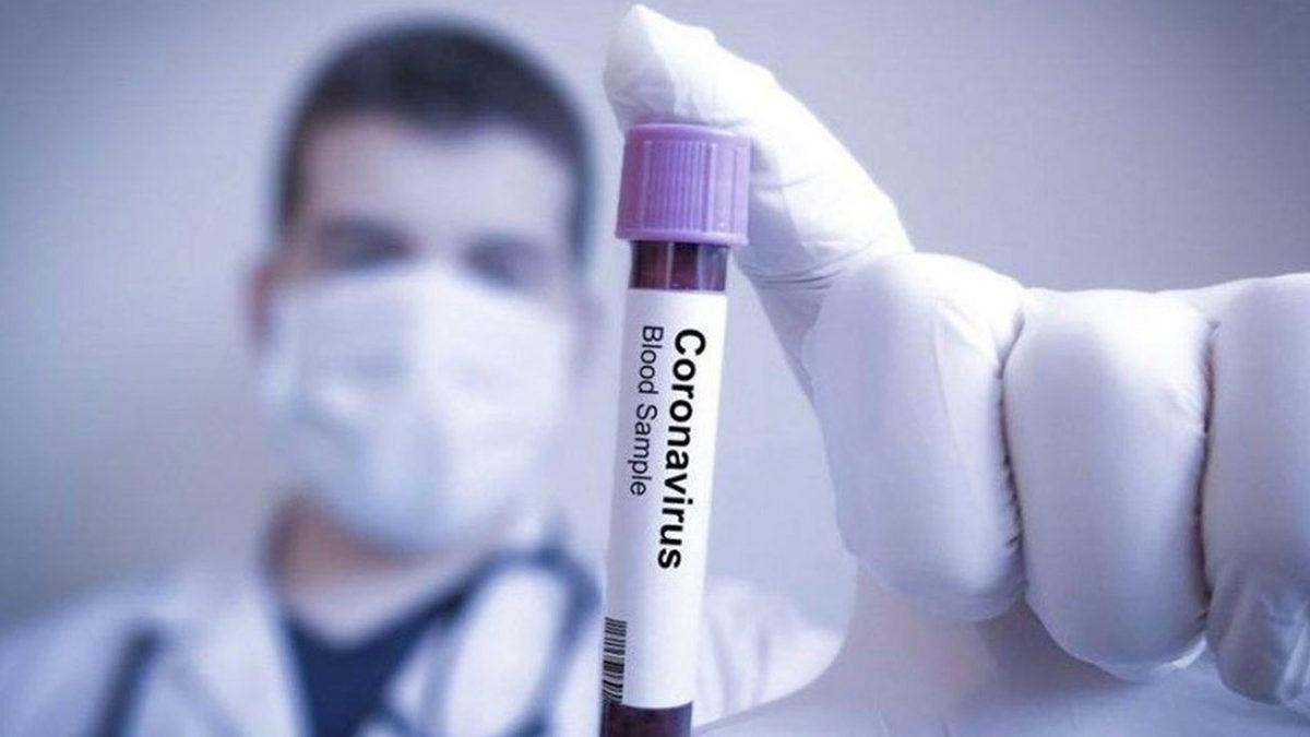 Corona Virüsü Testi Nerede ve Nasıl Yapılıyor? Türkiye’de İşleyen Tüm Prosedürü Adım Adım Anlattık