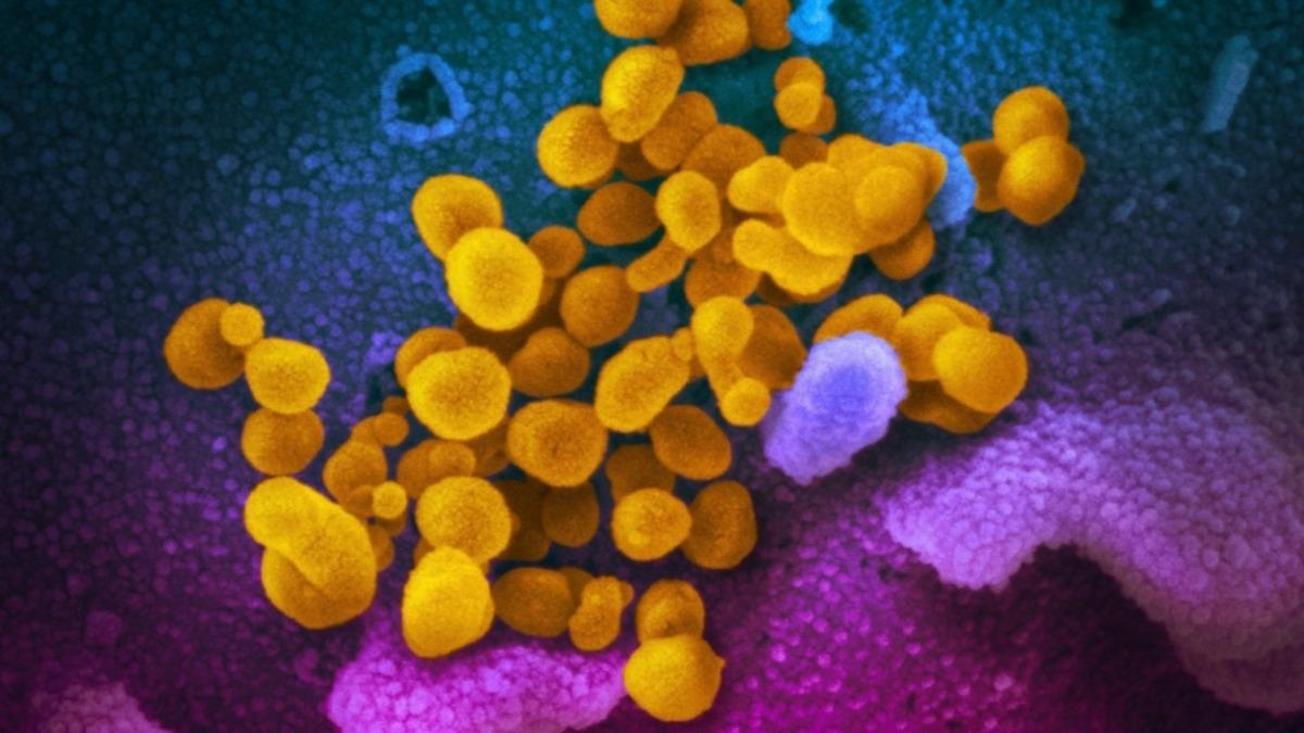 SARS’a Yüzde 80’e Yakın Benzeyen COVID-19, Neden Çok Daha Fazla Kişiye Bulaştı?