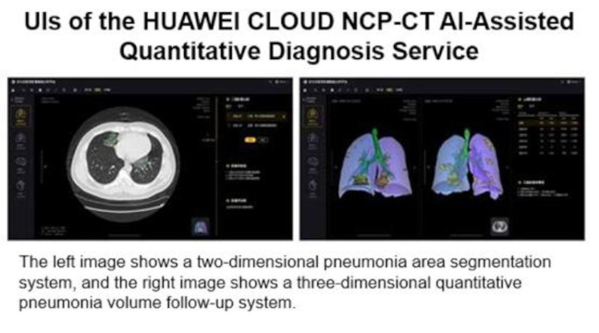 Huawei, Yapay Zeka Destekli Koronavirüs Tanı Hizmeti Geliştirdi
