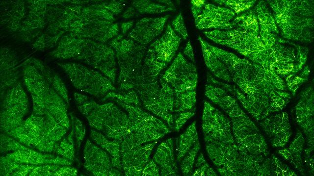 Beyin Sinyallerini Yakalayabilecek Yeni Bir Mikroskop Geliştirildi