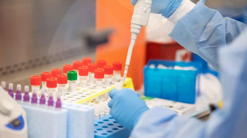 Türkiye’de 1250 TL’ye Yasa Dışı Koronavirüs Testi Yapıldığı Ortaya Çıktı