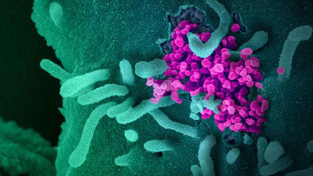 Koronavirüse Karşı Kullanılması Muhtemel Geçici Tedavi