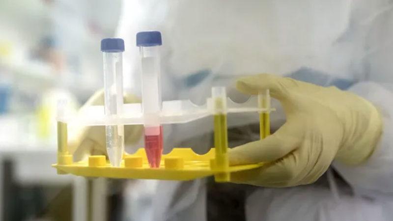 Koronavirüse Karşı Kullanılması Muhtemel Geçici Tedavi