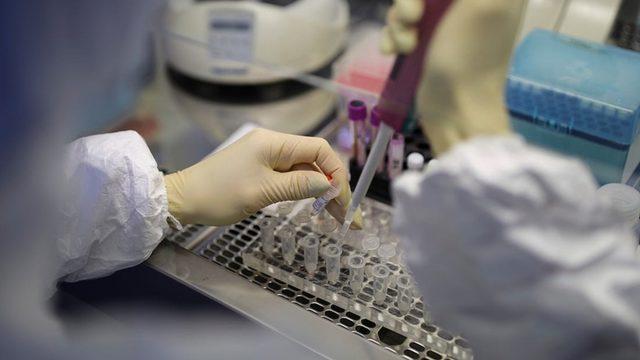 Çin’den Alınan ve 15 Dakikada Koronavirüs Tespiti Yapan Kitler Türkiye’ye Ulaştı