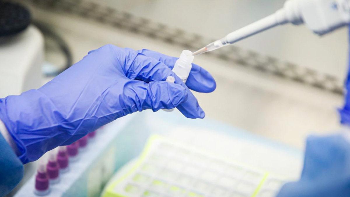 İngiltere’de Açıkgöz Bir Doktor Onaysız ‘Koronavirüs Testi’ Satıp 19 Milyon TL Değerinde Vurgun Yaptı