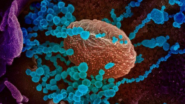 SARS-CoV-2, İki Farklı Virüsün Birleşmesinden Ortaya Çıkmış Olabilir