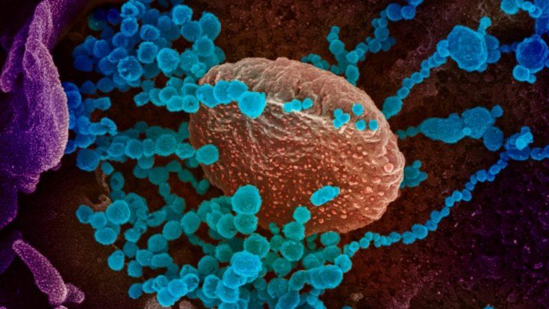 SARS-CoV-2, İki Farklı Virüsün Birleşmesinden Ortaya Çıkmış Olabilir