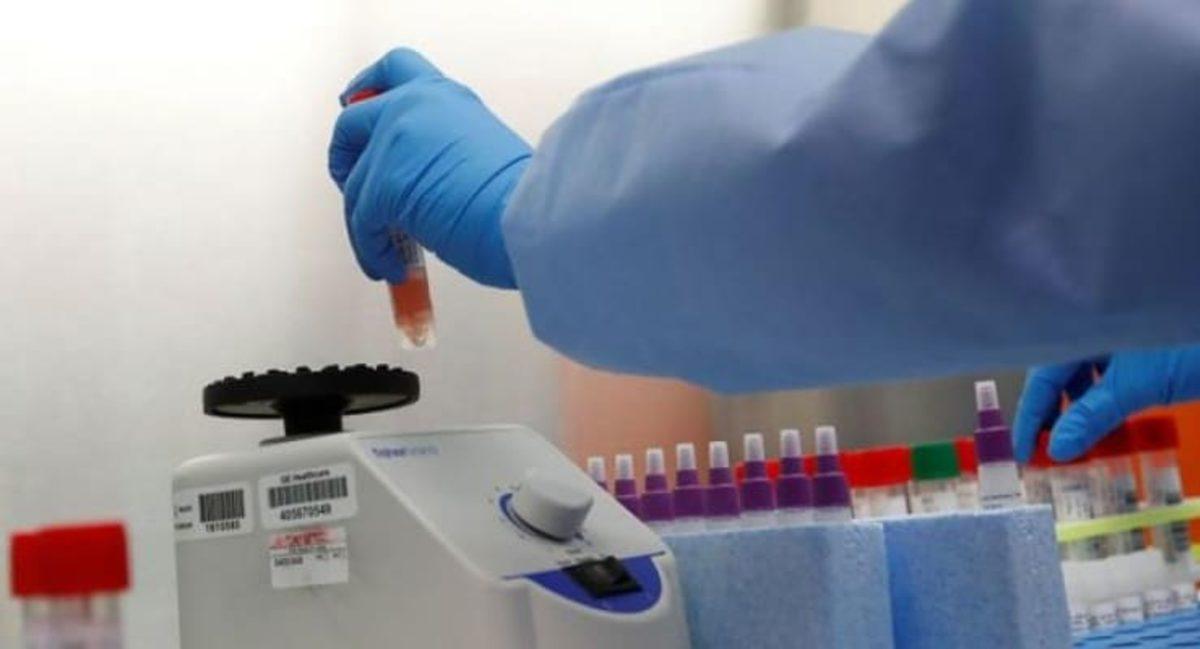 Koronavirüs Hastalarında Yaygın Görülen Olası Bir Belirti Ortaya Çıktı