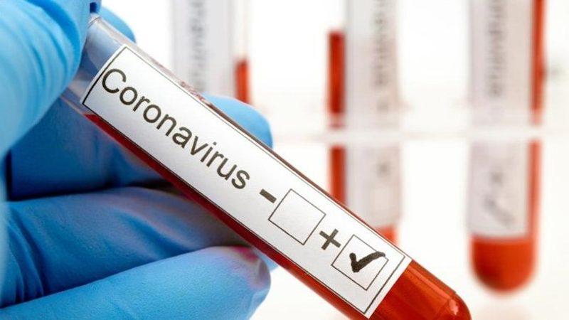 Koronavirüs Hastalarında Yaygın Görülen Olası Bir Belirti Ortaya Çıktı