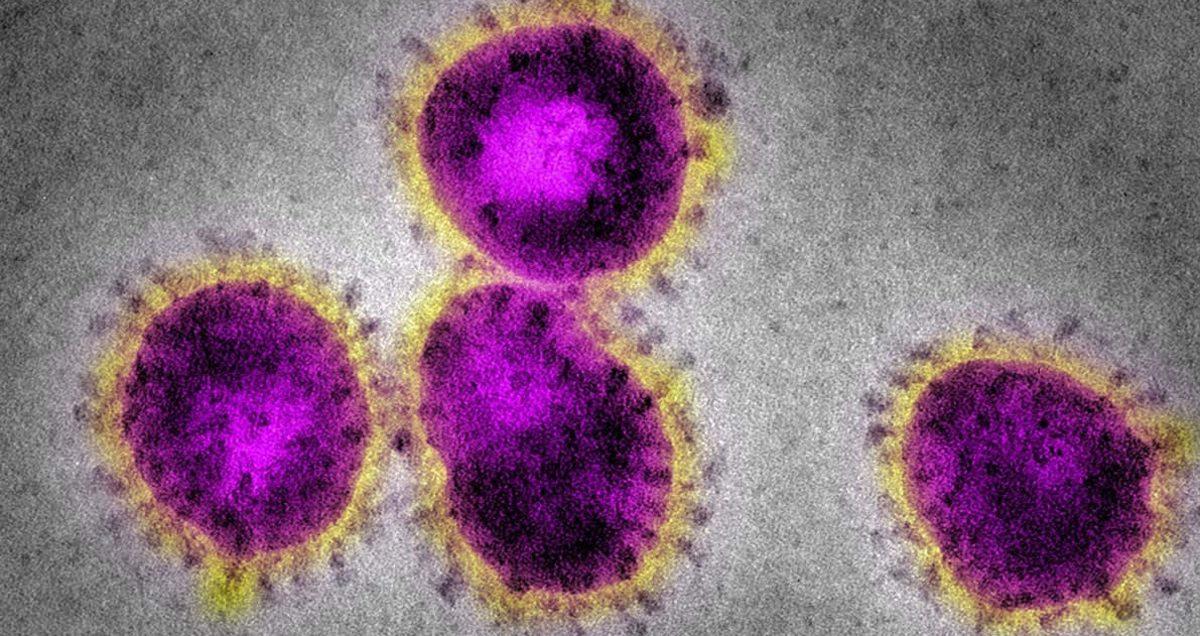 Hollanda’nın Kanalizasyon Sularında Koronavirüs Tespit Edildi