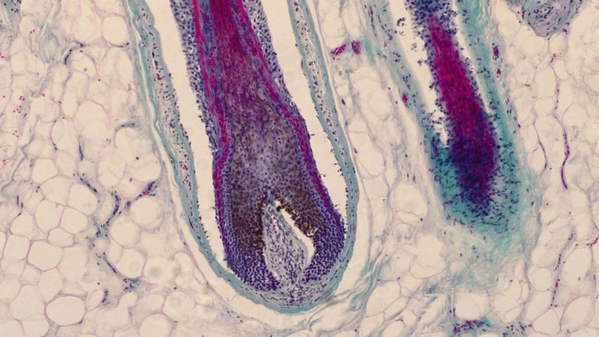 Bilim İnsanları, Saç Dökülmesini Tersine Çevirecek Bir Teknik Geliştirdi