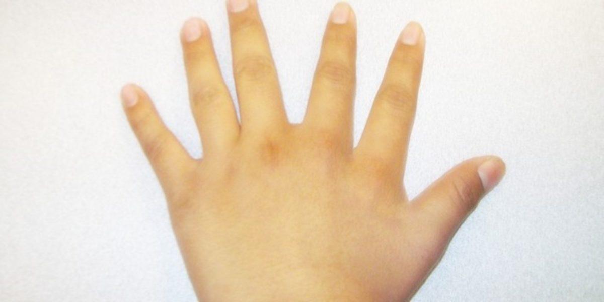 Araştırmaya Göre Altıncı Parmaklar, Doktorların Söylediği Kadar Kullanışsız Değiller