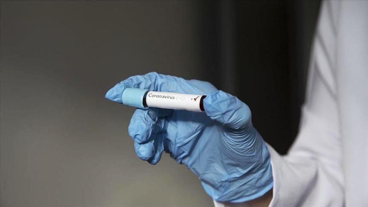 Koronavirüse Hiçbir Önlem Almayan Tek Ülke: Belarus