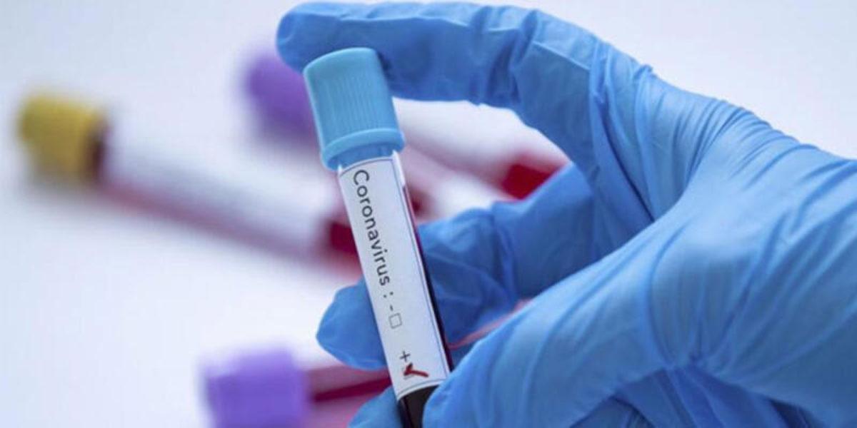 Dünya Sağlık Örgütü: Koronavirüs Aşısına En Az 1 Sene Var