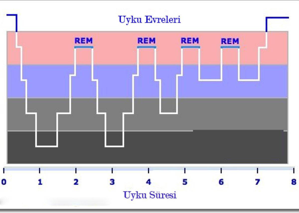 Alarm Çaldığında ’Ertele’ Tuşuna Basmanın Beynin Afallamasına Yol Açtığı Anlaşıldı