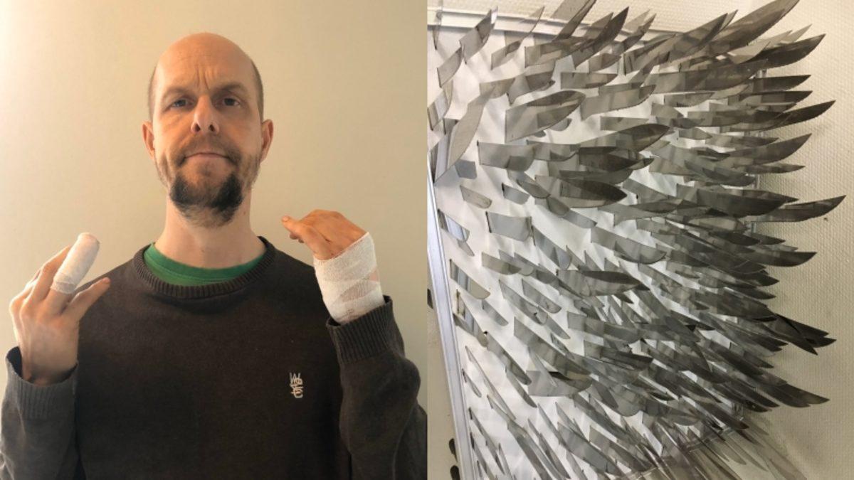 Bıçaklarla Balon Patlatan Norveçli Fenomen Ölümden Döndü