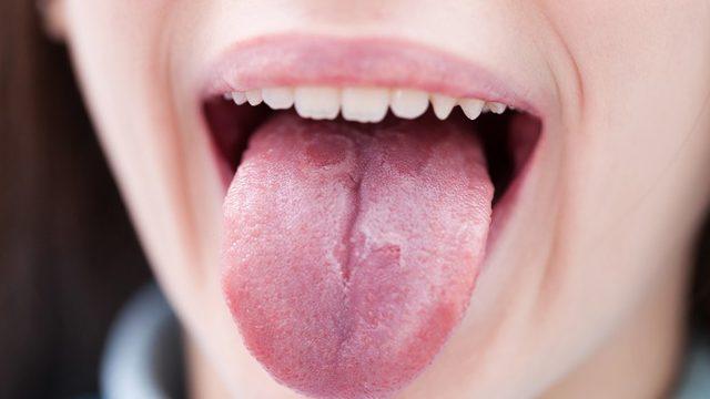 Görme İşleminde Kullanılan Bir Proteinin Tat Almada da Kullanılabildiği Keşfedildi