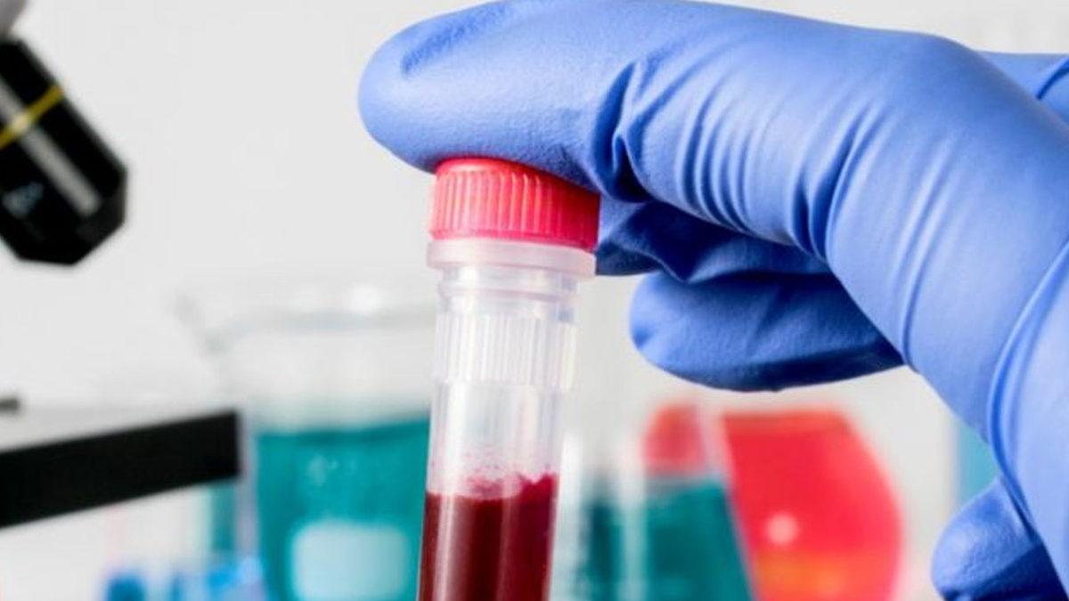 Koyun Dolly’yi Klonlayan Ekip, Koronavirüs Tedavisi Üzerinde Çalışıyor