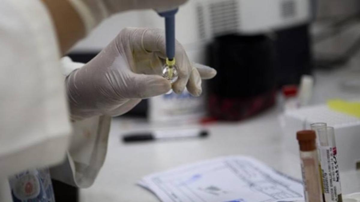 Bilim İnsanları, Parazit Öldürücü Bir İlacın Koronavirüsü Yok Ettiğini Keşfetti