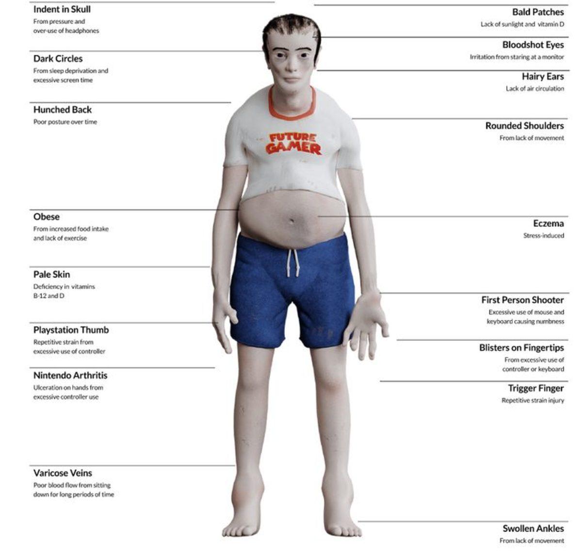 Video Oyun Bağımlılarının 20 Yıl Sonra Nasıl Görünecekleriyle İlgili Korkutan Tahmin