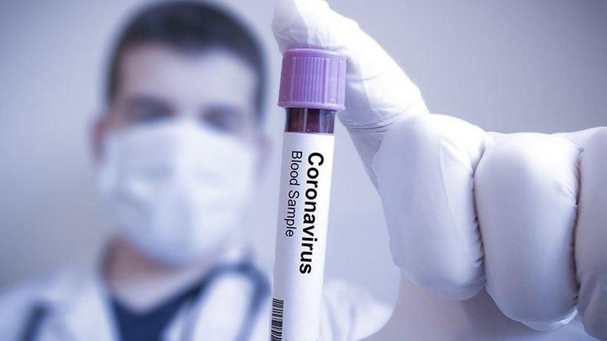 Dünya Genelinde Koronavirüse Bağlı Ölüm Sayısı 100 Bini Aştı