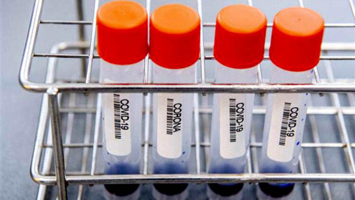 Bilim Kurulu Üyesi: Türkiye’deki Koronavirüs Vakaları Plato Çizerek Yavaş Yavaş Azalacak