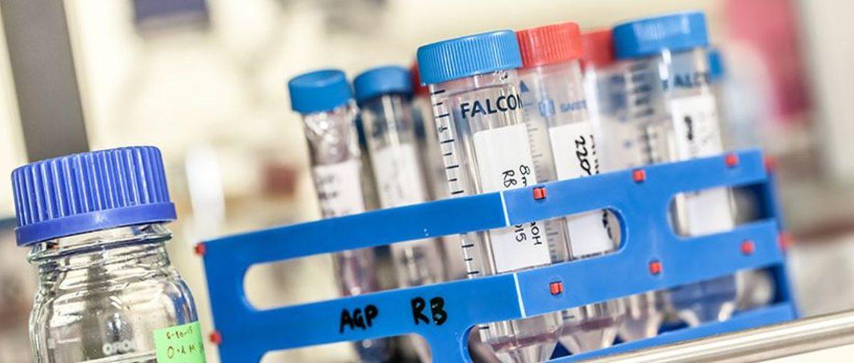 Rusya Sağlık Bakanı, Koronavirüse Karşı Yeni İlaç Geliştirdiklerini Açıkladı