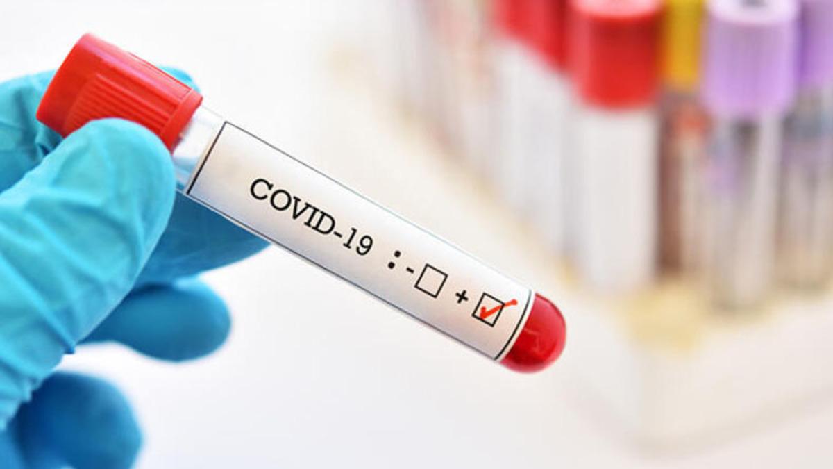 Rusya Sağlık Bakanı, Koronavirüse Karşı Yeni İlaç Geliştirdiklerini Açıkladı