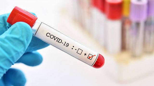 Rusya Sağlık Bakanı, Koronavirüse Karşı Yeni İlaç Geliştirdiklerini Açıkladı