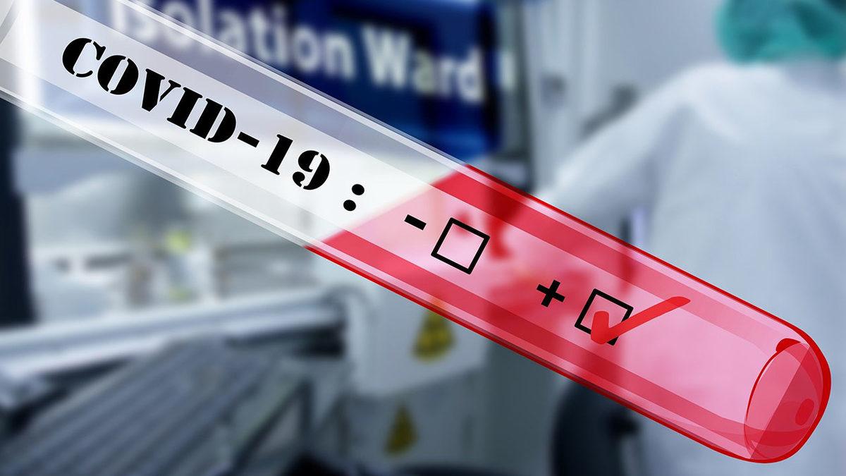 ’Filyasyon’ Nedir, Koronavirüs Salgınında Ne Önemi Var?