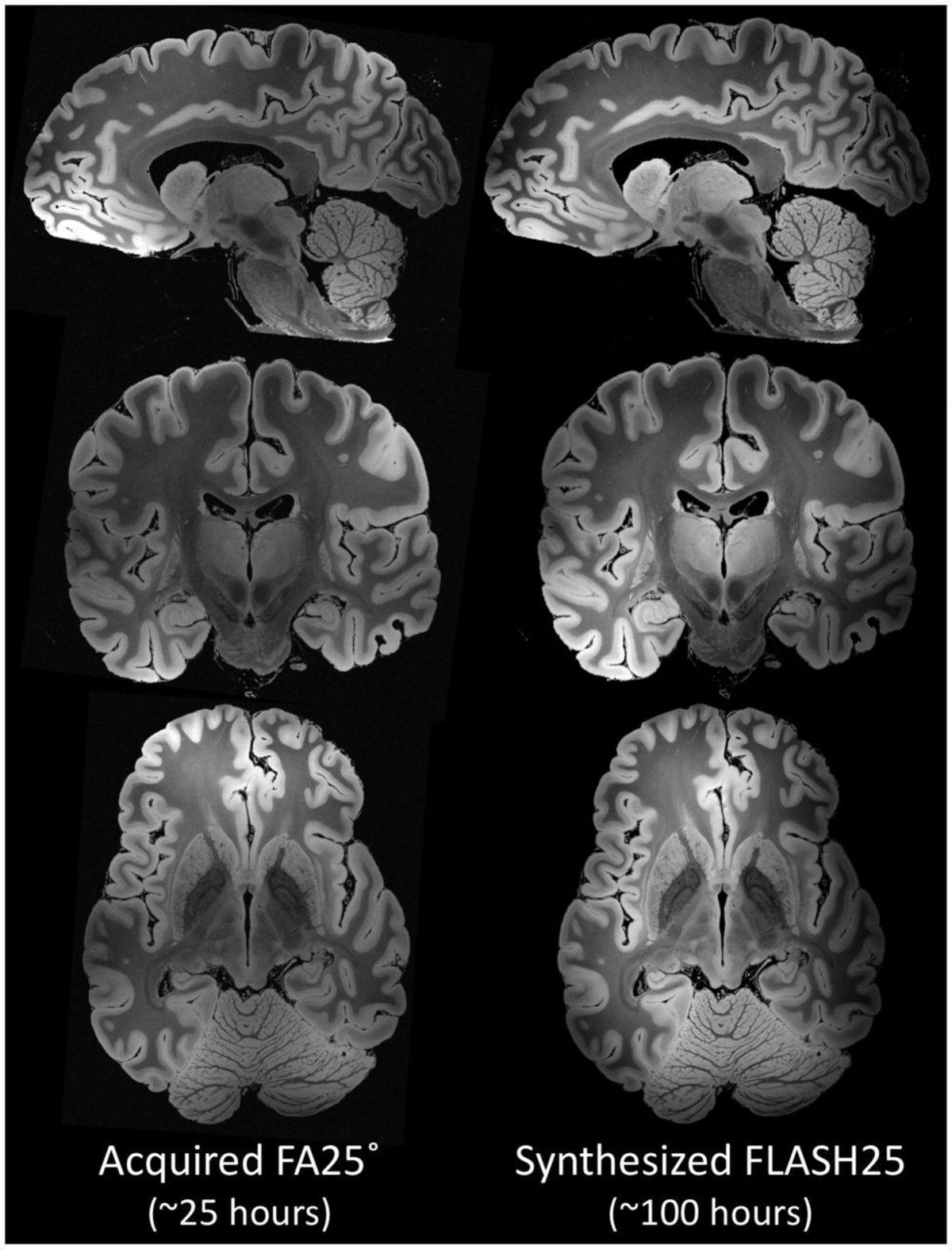 İnsan Beyninin 100 Saatlik MR ile Elde Edilen Ultra Yüksek Çözünürlüklü 3D Görüntüsü (Video)