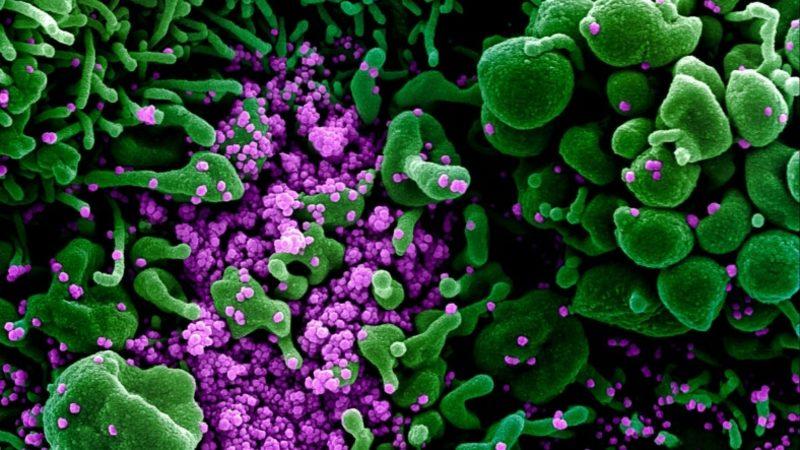 COVID-19’un Yeni Bir Semptomu Daha Keşfedildi