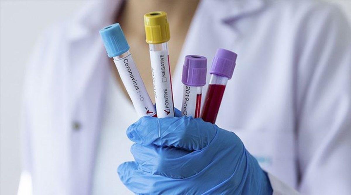 Nobel Ödüllü Virologdan Ortalığı Karıştıracak İddia: Koronavirüs Laboratuvarda Üretildi