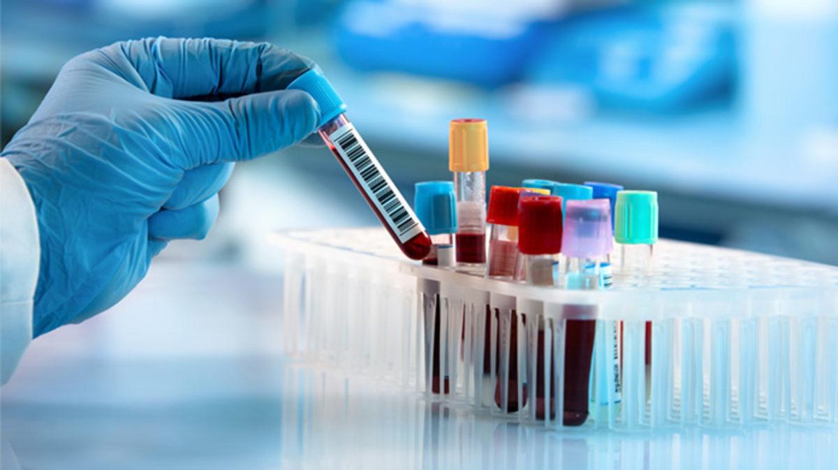 Nobel Ödüllü Virologdan Ortalığı Karıştıracak İddia: Koronavirüs Laboratuvarda Üretildi