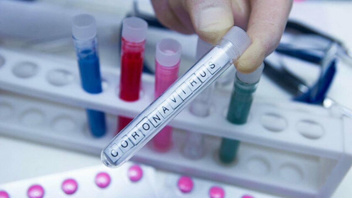 Nobel Ödüllü Virologdan Ortalığı Karıştıracak İddia: Koronavirüs Laboratuvarda Üretildi