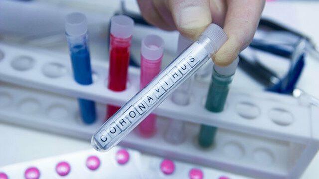 Nobel Ödüllü Virologdan Ortalığı Karıştıracak İddia: Koronavirüs Laboratuvarda Üretildi