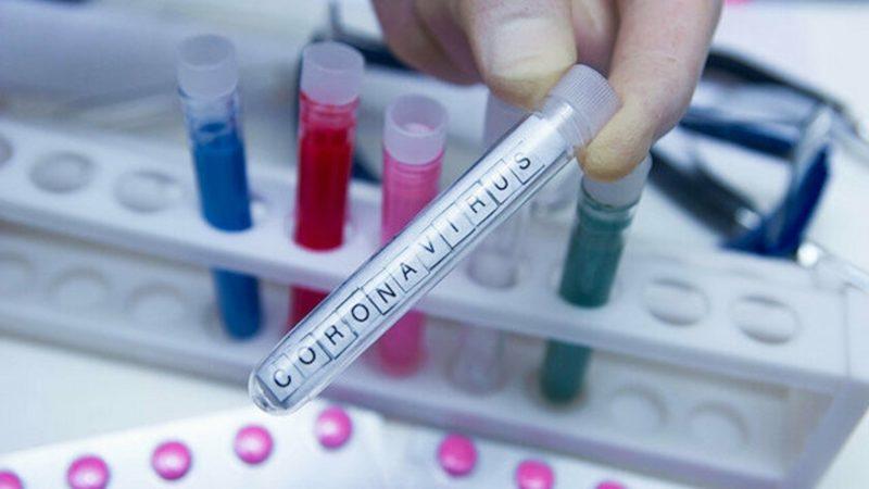 Nobel Ödüllü Virologdan Ortalığı Karıştıracak İddia: Koronavirüs Laboratuvarda Üretildi