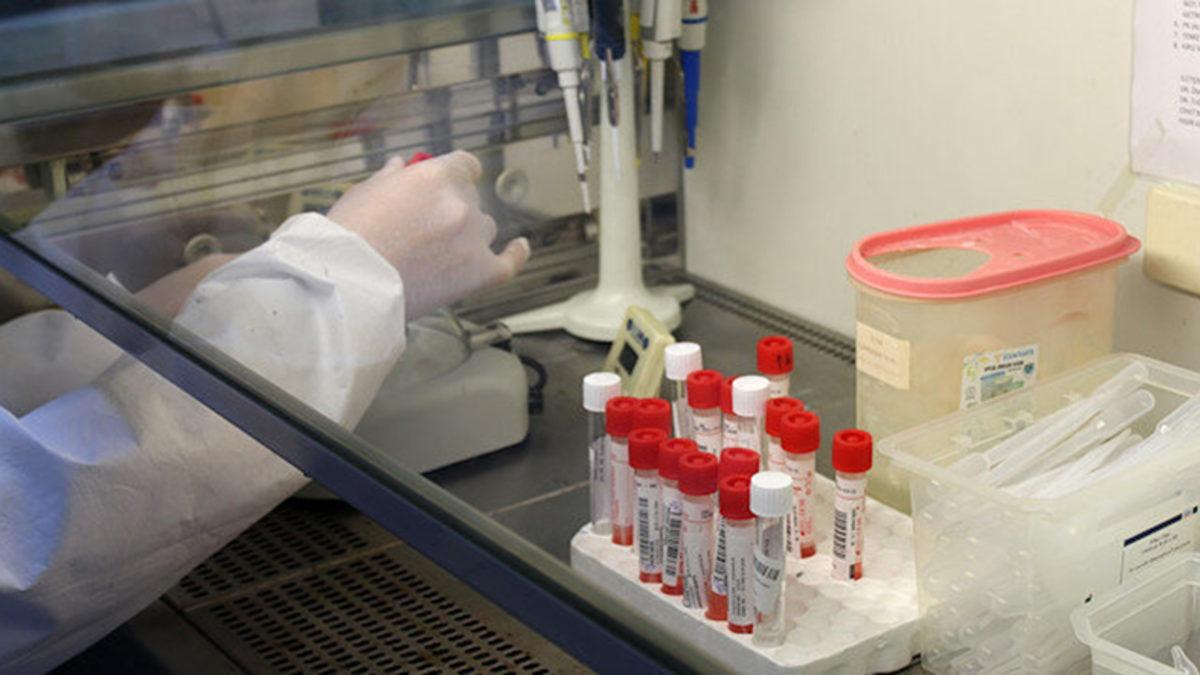 Bilim İnsanlarına Göre Koronavirüs İlaçları, Java Maymunları Üzerinde Denenebilir