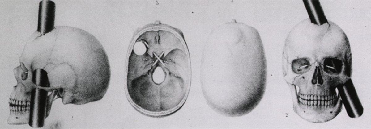Her İnsan Beyninde Bulunan Gerçek Süper Güç: Nöroplastisite