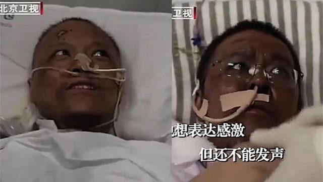 Bilim Kurulu Üyesi, Ten Rengi Değişen Çin’deki Doktorlar Hakkında Açıklama Yaptı