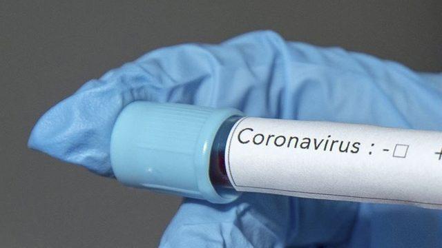 Bill Gates, Koronavirüsü Tek Taraflı Bir Dünya Savaşına Benzetti