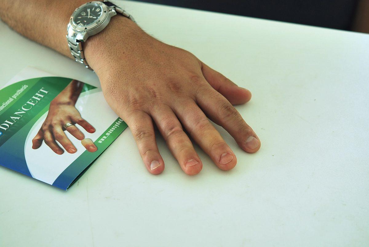 Kişinin Hayatını Değiştiren 8 Mucize Protez Buluşu